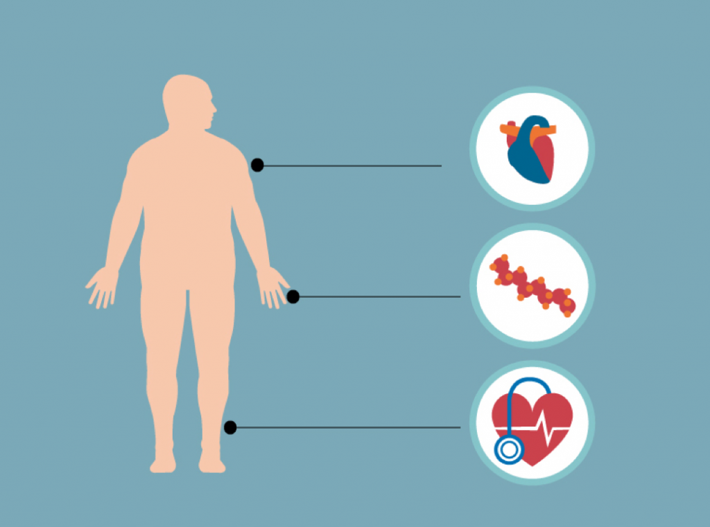 Síndrome Metabólica Síndrome Metabólica
